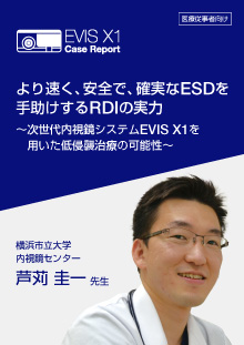EVIS X1 Case Report より速く、安全で、確実なESDを手助けするRDIの実力～次世代内視鏡システムEVIS X1 を用いた低 ...